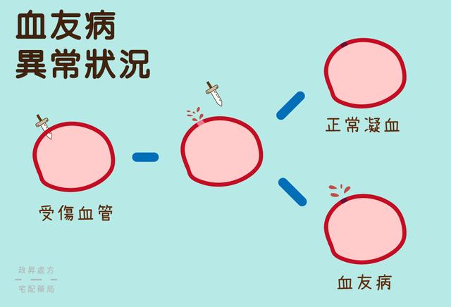 血友病A最新研究及治疗进展